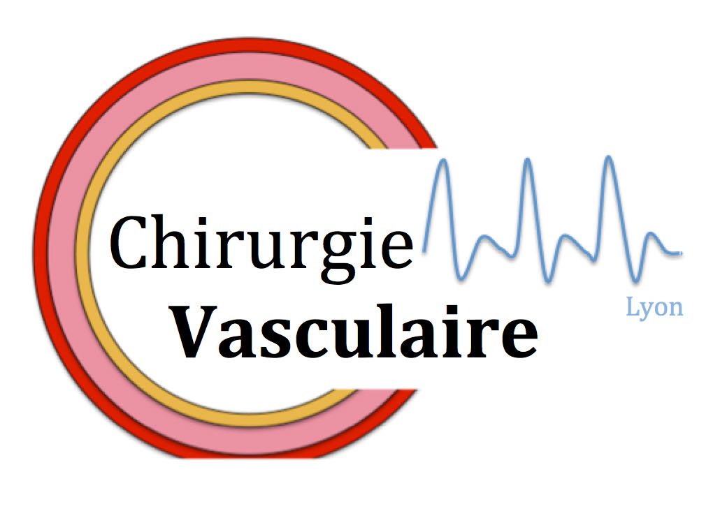 Unité de chirurgie vasculaire lyon 69