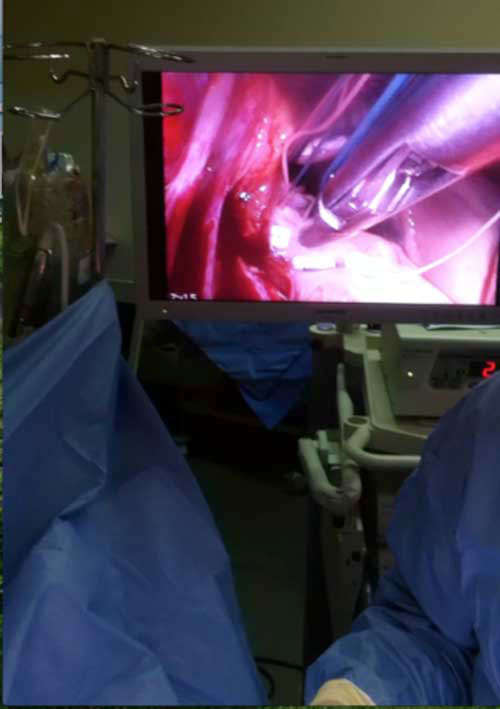 Cardioplégie cristalloïde